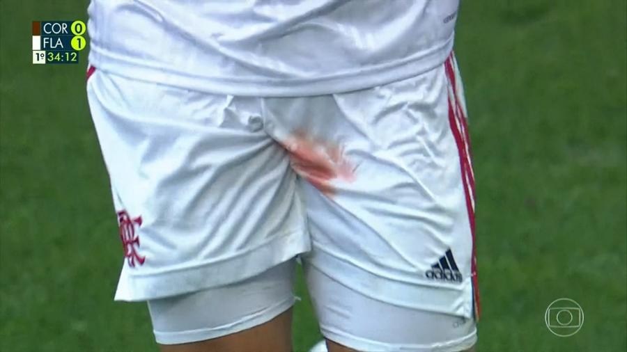 Zagueiro-do-Flamengo-sofre-trauma-no-testículo-e-sai-com-calção-sangrando-de-jogo-contra-o-Corinthians