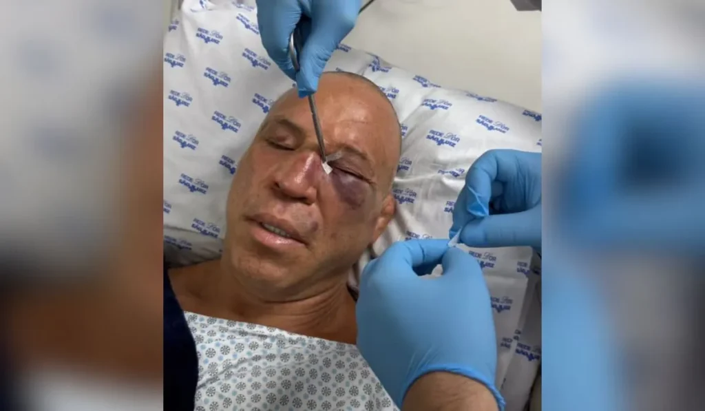 Wanderlei Silva sofre fratura no nariz após confusão em luta contra Popó