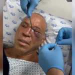 Wanderlei Silva sofre fratura no nariz após confusão em luta contra Popó