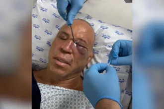 Wanderlei Silva sofre fratura no nariz após confusão em luta contra Popó