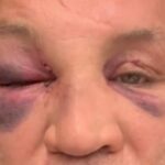 Wanderlei Silva diz sofrer fortes dores de cabeça após confusão em luta com Popó