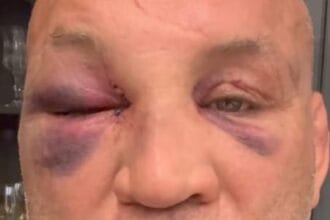 Wanderlei Silva diz sofrer fortes dores de cabeça após confusão em luta com Popó