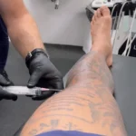 Memphis Depay passa por punção no joelho esquerdo e recebe aplicação de ácido hialurônico no Corinthians
