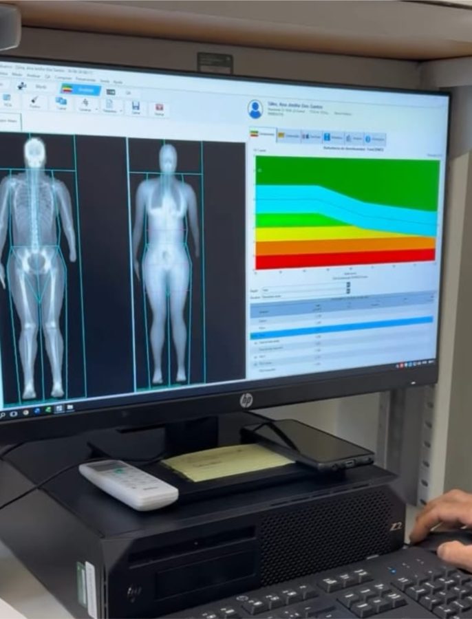 dexa